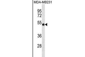 UBR7 Antibody (N-term) (ABIN1881973 and ABIN2838438) western blot analysis in MDA-M cell line lysates (35 μg/lane). (UBR7 antibody  (N-Term))