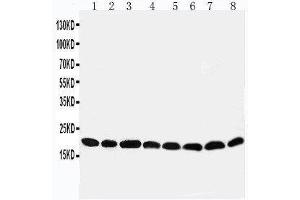 Western Blotting (WB) image for anti-Peroxiredoxin 5 (PRDX5) (AA 166-181), (C-Term) antibody (ABIN3044202)