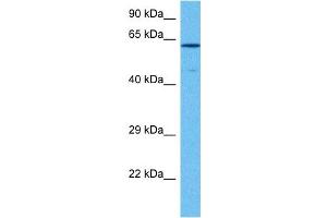 Western Blotting (WB) image for anti-SRY (Sex Determining Region Y)-Box 10 (SOX10) (Middle Region) antibody (ABIN2777864)