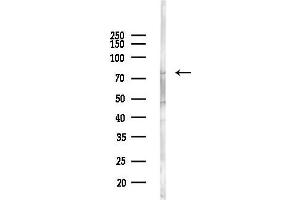 anti-H2.0-Like Homeobox (HLX) (Internal Region) antibody