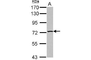 Western Blotting (WB) image for anti-TBC1 Domain Family, Member 15 (TBC1D15) (N-Term) antibody (ABIN1494104) (TBC1D15 antibody  (N-Term))