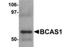 Western blot analysis of BCAS1 in human lung tissue lysate with BCAS1 antibody at 1 μg/ml.