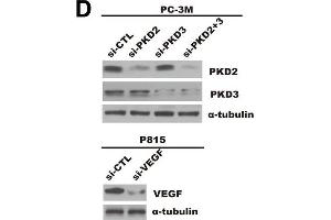 Prostate cancer cells-derived PKD2/3 promote chemotactic migration of mast cells and endothelial cells tube formation. (VEGFA antibody  (AA 27-126))