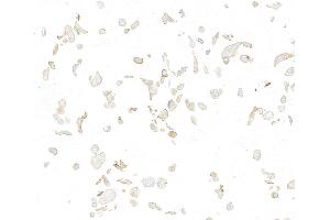 Immunocytochemistry (ICC) image for anti-Met Proto-Oncogene (MET) (C-Term) antibody (ABIN7795683)