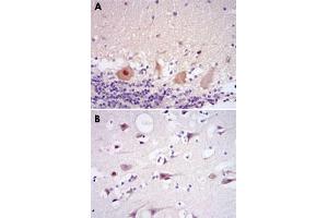Immunohistochemical analysis of paraffin-embedded human cerebellum tissues (A) and brain tissues (B) using CDK5 monoclonal antibody, clone 4E4  with DAB staining. (CDK5 antibody)