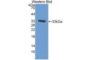 Detection of Recombinant TFPI, Rat using Monoclonal Antibody to Tissue Factor Pathway Inhibitor (TFPI) (TFPI antibody  (AA 29-302))