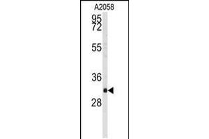 Western blot analysis of anti-BP2 Antibody in A2058 cell line lysates (35ug/lane) (WBP2 antibody  (C-Term))