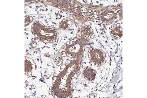 Immunohistochemical staining of human breast with OAS3 polyclonal antibody  shows moderate cytoplasmic positivity in glandular cells at 1:500-1:1000 dilution. (OAS3 antibody)
