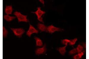 ABIN6275648 staining HeLa by IF/ICC. (PTPN22 antibody  (C-Term))