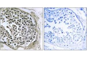 Immunohistochemistry analysis of paraffin-embedded human testis tissue, using GIDRP88 Antibody.