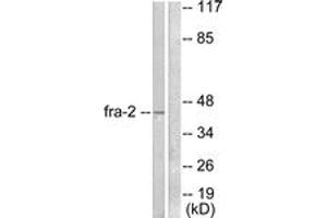 Western blot analysis of extracts from LOVO cells, using Fra-2 Antibody. (FOSL2 antibody  (AA 271-320))