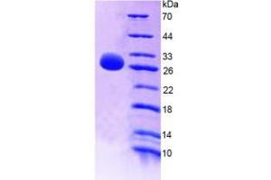 Image no. 1 for Interleukin 22 Receptor, alpha 2 (IL22RA2) (AA 31-223) protein (His tag) (ABIN4990298) (IL22RA2 Protein (AA 31-223) (His tag))