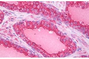 Immunohistochemistry (IHC) image for anti-ATG5 Autophagy Related 5 (ATG5) (AA 8-318) antibody (ABIN1100127)