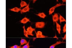 Immunofluorescence analysis of PC-12 cells using SERPINA12 Polyclonal Antibody at dilution of 1:100 (40x lens). (SERPINA12 antibody)