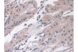 Immunohistochemistry (IHC) image for anti-Phospholipase D (PLD) (AA 725-1074) antibody (ABIN7434611)