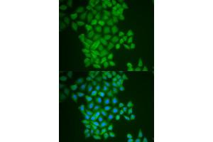 Immunofluorescence analysis of MCF-7 cell using FTH1 antibody. (FTH1 antibody)