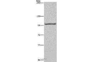 Western blot analysis of Raji cell, using NEDD9 Polyclonal Antibody at dilution of 1:650