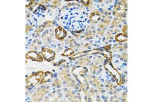 Immunohistochemistry of paraffin-embedded rat kidney using CASP3 antibody. (Caspase 3 antibody)