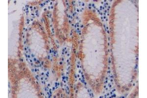 Detection of CD19 in Human Stomach Tissue using Polyclonal Antibody to Cluster Of Differentiation 19 (CD19) (CD19 antibody  (AA 160-258))