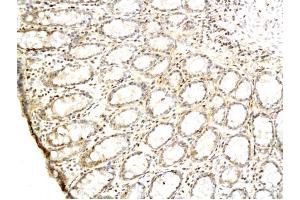 Formalin-fixed and paraffin embedded rat colon labeled with Anti-TGF alpha Polyclonal Antibody Unconjugated (ABIN724415) followed by conjugation to the secondary antibody and DAB staining (TGFA antibody  (AA 40-89))