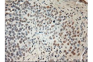 Immunohistochemical staining of paraffin-embedded colon tissue using anti-GAD1mouse monoclonal antibody. (GAD antibody)