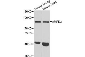 Western blot analysis of extracts of various cell lines, using AMPD3 antibody (ABIN5973764) at 1/1000 dilution. (AMPD3 antibody)
