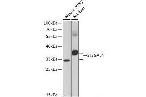 Western blot analysis of extracts of various cell lines using ST3GAL4 Polyclonal Antibody at dilution of 1:1000. (ST3GAL4 antibody)