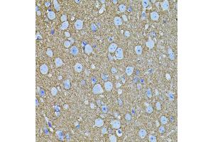Immunohistochemistry of paraffin-embedded mouse brain using STX1A antibody (ABIN5995405) (40x lens). (STX1A antibody)