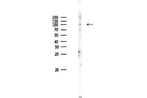 anti-F-Box Protein 11 (FBXO11) antibody