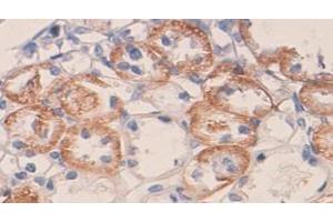 IHC staining of formalin-fixed paraffin-embedded rat kidney with VEGF protein staining, using VEGF antibody (1/100 dilution). (VEGF antibody  (N-Term))