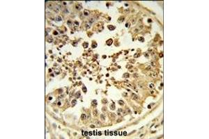 Formalin-fixed and paraffin-embedded human testis tissue reacted with DIH2 Antibody (Center), which was peroxidase-conjugated to the secondary antibody, followed by DAB staining. (DIAPH2 antibody  (AA 870-899))