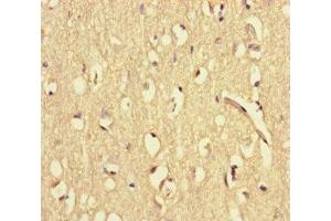 Immunohistochemistry of paraffin-embedded human brain tissue using ABIN7175867 at dilution of 1:100 (WAC antibody  (AA 10-102))