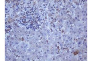 Image no. 8 for anti-DEAD (Asp-Glu-Ala-Asp) Box Polypeptide 59 (DDX59) (AA 1-303) antibody (ABIN1490728)