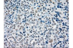 Immunohistochemical staining of paraffin-embedded colon tissue using anti-STK3mouse monoclonal antibody. (STK3 antibody)