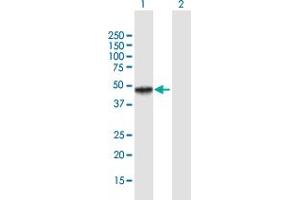 Western Blot analysis of MICB expression in transfected 293T cell line by MICB MaxPab polyclonal antibody.