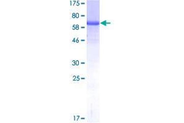 TIPIN Protein (AA 1-301) (GST tag)