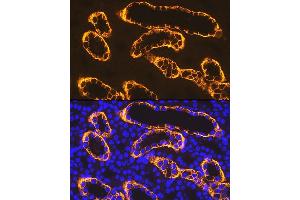 Immunofluorescence analysis of rat kidney using PDZK1 Rabbit mAb (ABIN7269199) at dilution of 1:100 (40x lens). (PDZK1 antibody)