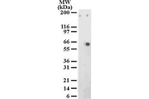 Image no. 1 for anti-Activating Transcription Factor 2 (ATF2) (pThr71) antibody (ABIN208166) (ATF2 antibody  (pThr71))
