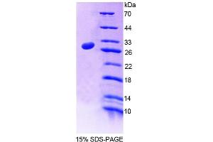 SDS-PAGE (SDS) image for Centromere Protein J (CENPJ) (AA 1-207) protein (His tag) (ABIN4989102)