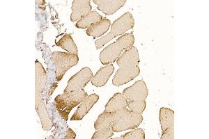 Immunohistochemistry of paraffin-embedded rat skeletal muscle using CLCN1 Rabbit pAb (ABIN6130939, ABIN6138661, ABIN6138662 and ABIN6221409) at dilution of 1:200 (40x lens). (CLCN1 antibody  (AA 779-988))