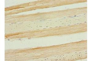Immunohistochemistry of paraffin-embedded human skeletal muscle tissue using ABIN7159666 at dilution of 1:100 (APIP antibody  (AA 1-242))