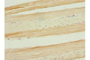 Immunohistochemistry of paraffin-embedded human skeletal muscle tissue using ABIN7159666 at dilution of 1:100
