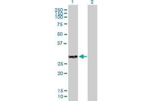 Western Blot analysis of CLEC4A expression in transfected 293T cell line by CLEC4A MaxPab polyclonal antibody.
