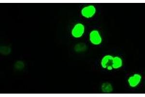 Image no. 18 for anti-Myc Proto-Oncogene protein (MYC) antibody (ABIN1497011) (c-MYC antibody)