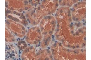 Immunohistochemistry (IHC) image for anti-Plexin B1 (PLXNB1) (AA 200-727) antibody (ABIN7438175)