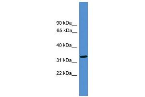 WB Suggested Anti-LUC7L Antibody Titration: 0.