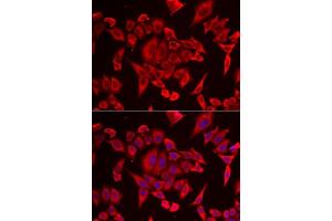 Immunofluorescence analysis of HeLa cells using SLC20A2 antibody. (SLC20A2 antibody  (AA 235-485))