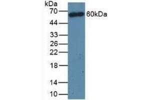 Detection of CD4 in Mouse Thymus Tissue using Polyclonal Antibody to Cluster Of Differentiation 4 (CD4) (CD4 antibody  (AA 27-394))