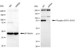 Western blotting analysis using Phospho-STAT1 (S727) antibody (ABIN7800334).