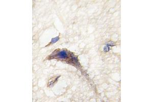 Formalin-fixed and paraffin-embedded human brain tissue reacted with DM1 Antibody (N-term) (ABIN389179 and ABIN2839342) , which was peroxidase-conjugated to the secondary antibody, followed by DAB staining. (DAAM1 antibody  (N-Term))